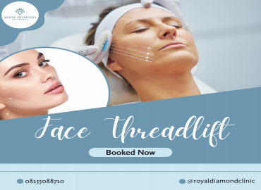 Wajah Sagging dan Perawatan Threadlift