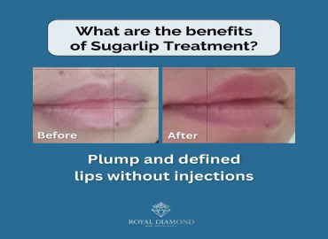 SUGAR LIPS